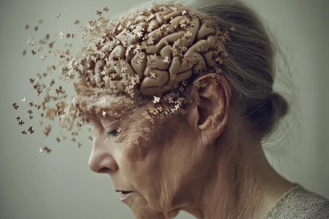 Kortikobasale Degeneration (CBD) - Eine seltene neurodegenerative Herausforderung
