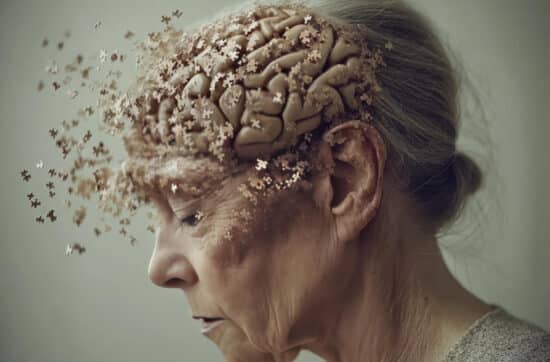 Kortikobasale Degeneration (CBD) - Eine seltene neurodegenerative Herausforderung