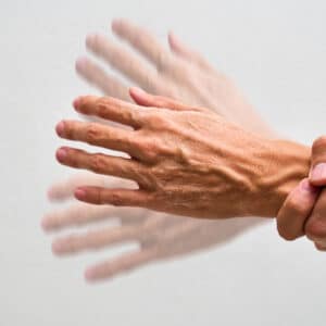 Schlafstörungen bei Parkinson – Ursachen, Formen und was wirklich hilft