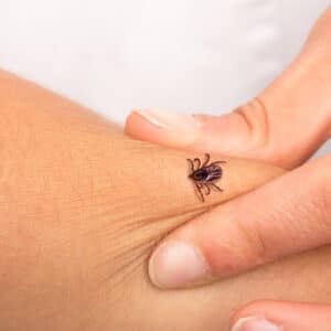 Borreliose-Symptome, die Ärzte oft übersehen