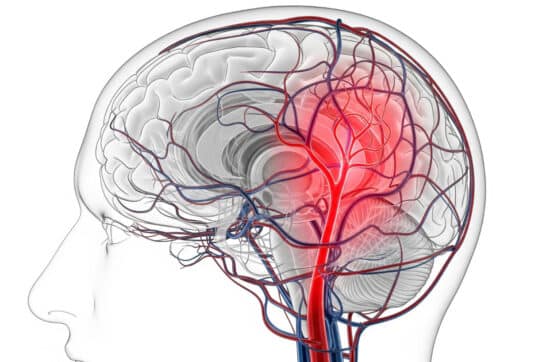 Hirnaneurysma: 8 Warnsignale, die Sie niemals ignorieren sollten