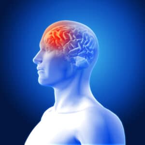 4 Warnzeichen eines Schlaganfalls, die Wochen oder Monate vorher auftreten können – Neurologe erklärt